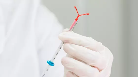 Médico da área de ginecologia prepara dispositivo contraceptivo